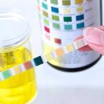 Bandelettes urinaires 3P : Glucose - Protéine - Acétone (RAPID LAB) 