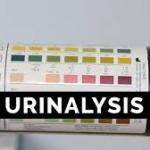 BANDELETTE URINAIRE 2P GLUCOSE ACETONE